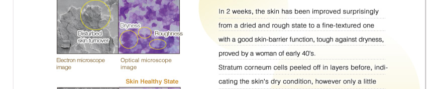 In 2 weeks, the skin has been improved surprisingly from a dried and rough state to a fine-textured one with a good skin-barrier function, tough to dryness.
Stratum corneum cells peeled off in layers before, indicating the skin's dry condition, however only a little layers found in two weeks.